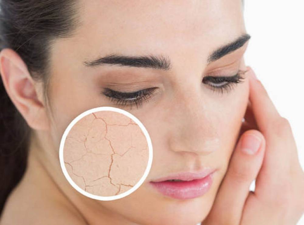 EO THON, DÁNG ĐẸP AN TOÀN HIỆU QUẢ BẰNG THUỐC ĐÔNG Y